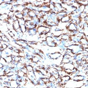Monoclonal anti Smooth Muscle Actin (ACTA2/791)