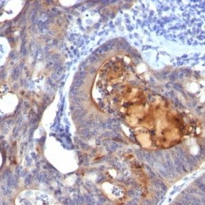 Monoclonal anti IgA Secretory Component (ECM1/792)