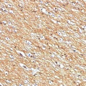 Monoclonal anti CD56 / NCAM (NCAM1/795)