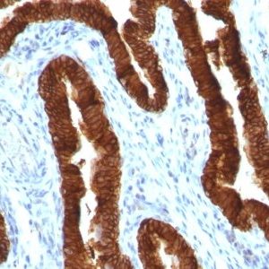 Monoclonal anti Cytokeratin 19 (KRT19/800)
