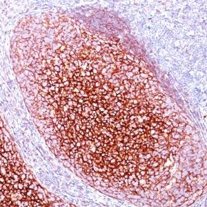 Monoclonal anti CD35 / CR1 (CR1/802)
