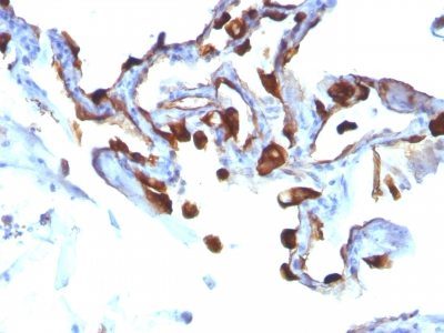 Monoclonal anti Cytokeratin 8 (KRT8/803)