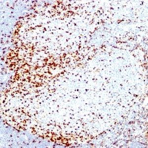 Monoclonal anti ZAP70 (2F3.2)