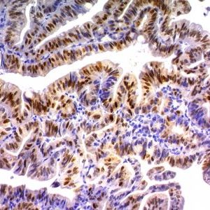 Monoclonal anti p21 / WAF1 (DCS 60.2)