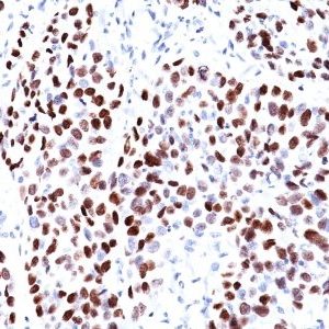 Monoclonal anti p21 / WAF1 (CIP1/823)