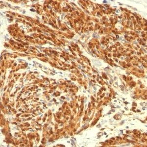 Monoclonal anti Calponin 1 (CALP)