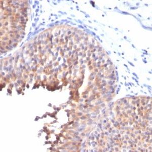 Monoclonal anti Cytokeratin 10 (KRT10/844)