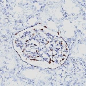 Monoclonal anti WT1 (Wilm's Tumor 1) (6F H2)