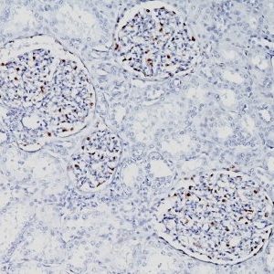 Monoclonal anti WT1 (Wilm's Tumor 1) (WT1/857)