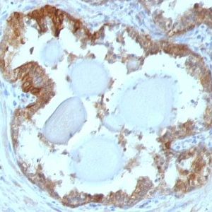 Monoclonal anti HSP27 (G3.1)