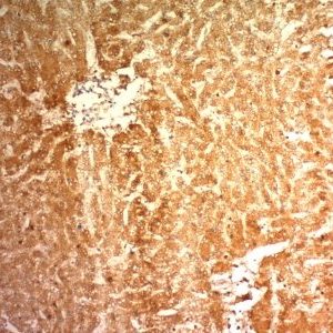 Monoclonal anti Glypican 3 (1G12)