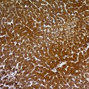 Monoclonal anti Glypican 3 (GPC3/863)