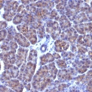 Monoclonal anti Golgi Complex (AE 6)