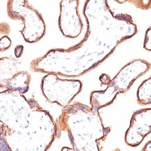 Monoclonal anti PLAP (Placental Alkaline Phosphatase) (ALPP/870)