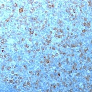 Monoclonal anti p34 / cdk1 (CDK1/873)