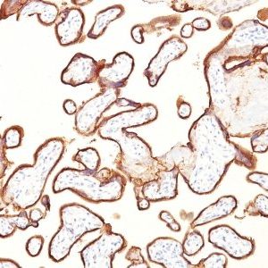 Monoclonal anti PLAP (Placental Alkaline Phosphatase) (GM022)