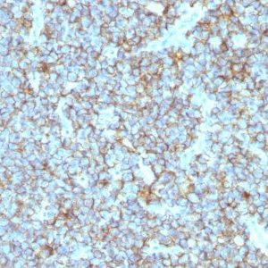 Monoclonal anti CD99 (MIC2/877)