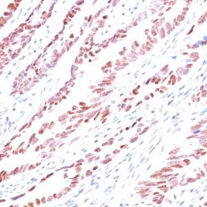 Monoclonal anti p57 / KIP2 (KP10)