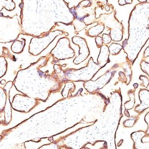 Monoclonal anti PLAP (Placental Alkaline Phosphatase) (PL8 F6)