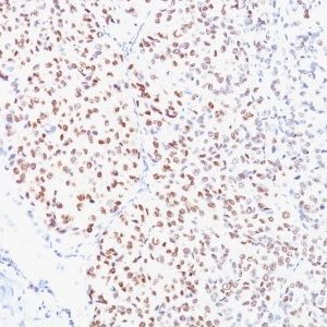 Monoclonal anti MiTF (Microphthalmia Transcription Factor) (C5/D5)