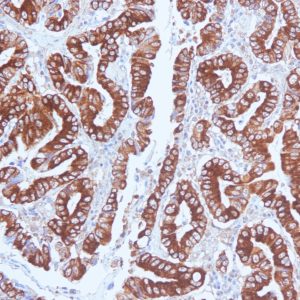 Mucin 5AC / MUC 5AC Monoclonal Mouse Antibody (CLH2)