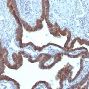 Monoclonal anti Cytokeratin 7 (KRT7/903)