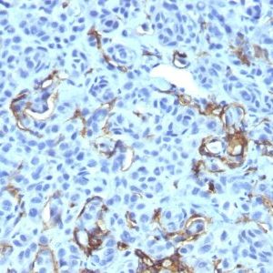 Monoclonal anti NGFR (Nerve Growth Factor Receptor) (NGFR5 + NTR/912)