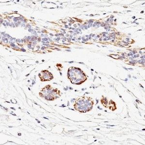 Monoclonal anti Myosin, Smooth Muscle Heavy Chain (MYH11/923)