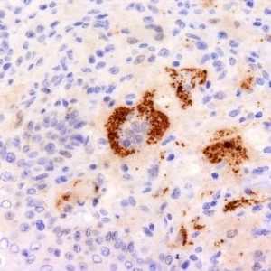 Monoclonal anti TNF alpha (P/T2)