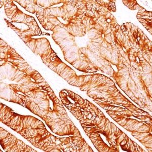Monoclonal anti Cytokeratin 5/8 (C 50)