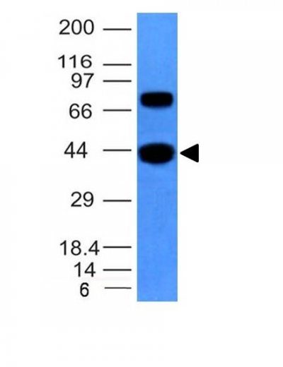 Monoclonal anti Muscle Specific Actin (MSA/953)