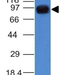 Monoclonal anti UACA / Nucling (AE 5)