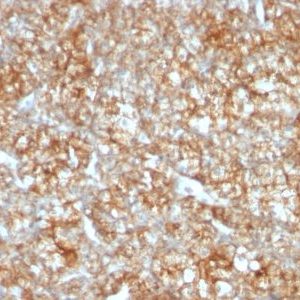 Monoclonal anti CD147 (BSG/963)