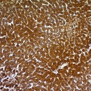 Monoclonal anti Hepatocyte Specific (HepPar1)