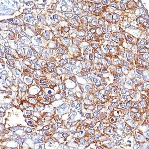 Monoclonal anti Ep CAM / CD326 (EGP40/826 + EGP40/837 + EGP40/1110 + EGP40/1120)