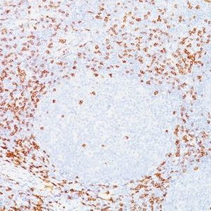 Monoclonal anti CD7 (T3 3A1)