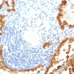 Monoclonal anti Cytokeratin 8/18 (KRT8/803 + KRT18/835)