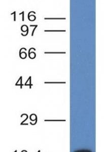 Monoclonal anti CD117 (KIT/983)