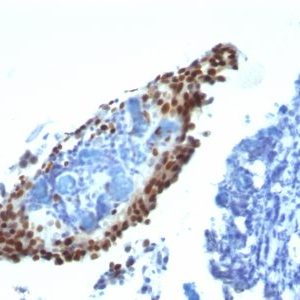 Monoclonal anti p21 / WAF1 (HJ21)
