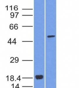 Monoclonal anti SOX10 (SOX10/992)