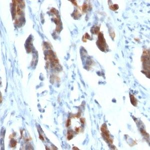 Monoclonal anti Mucin 5AC (MUC5AC) (58M1)