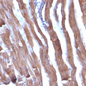 Monoclonal anti Muscle Specific Actin (HHF35 + MSA/953)