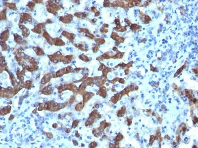 Monoclonal anti Hepatocyte Specific (CPS1/1022)