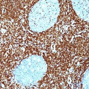 Monoclonal anti bcl 2 (BCL2/782 + BCL2/796)