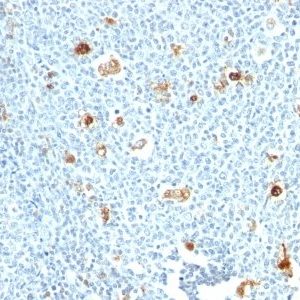 Monoclonal anti Calprotectin (CPT/1028)