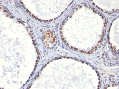 Monoclonal anti CD41a (ITGA2B/1036)
