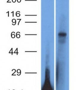Monoclonal anti TRIM29 (TRIM29/1042)