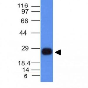 Monoclonal anti HLA DRB (HLA DRB/1067)