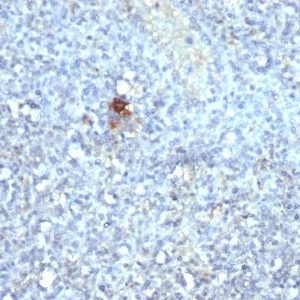 Monoclonal anti TRAcP (Tartarate Resistant Acid Phosphatase) (ACP5/1070)