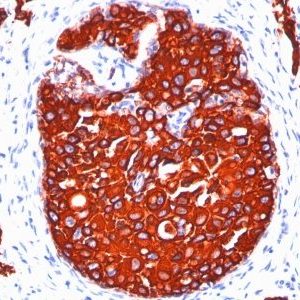 Monoclonal anti Cytokeratin, pan (KRTL/1077 + KRTH/1076)
